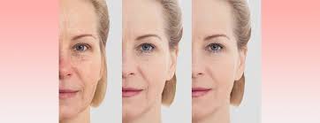 Facelift & Anti-Aging Procedures