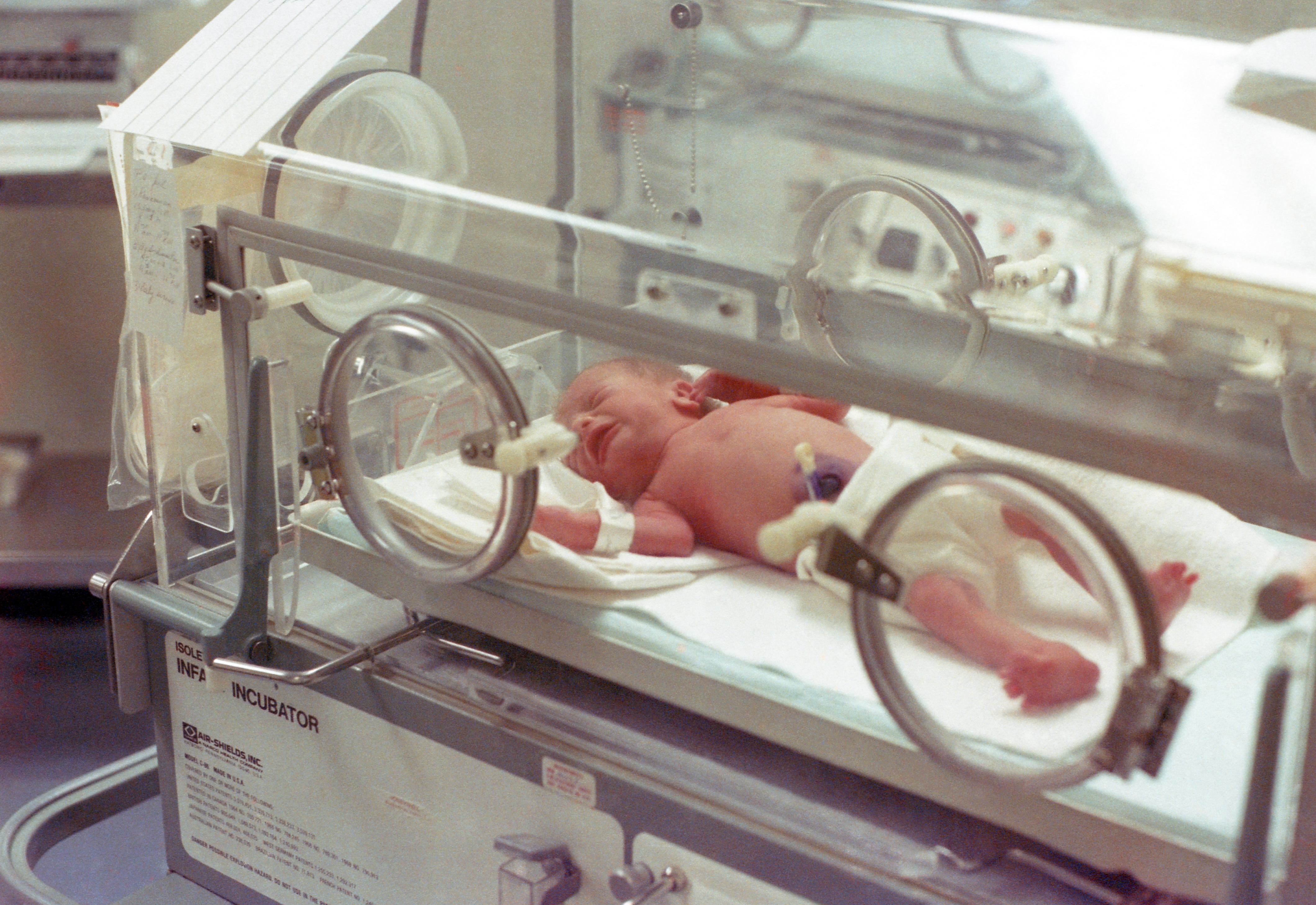 Neonatal Intensive Care (NICU)