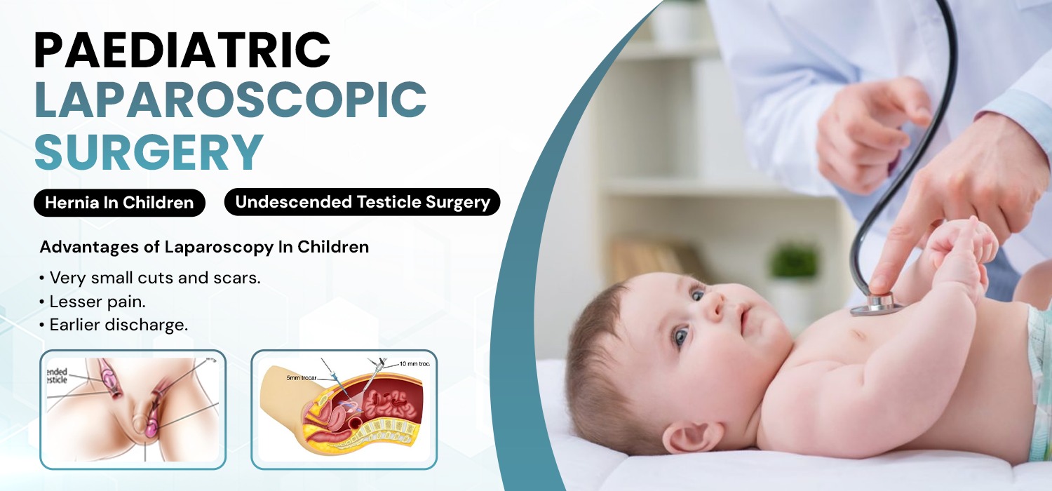 Pediatric Laparoscopic Surgery